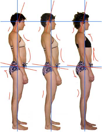 Body change before and after 11 Soma sessions.